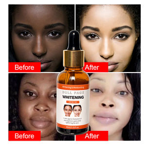 Private Label Pure Natural Arbutin Facial Whitening Serum Vegan Anti Aging Skin Essential Oil Aceite Esencial Face Care Serum