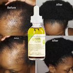Private Label 100% Natural Organic Scalp Care Hair Products Mix Herbs Rosemary Castor Oil Men Women Baby Hair Growth Oil